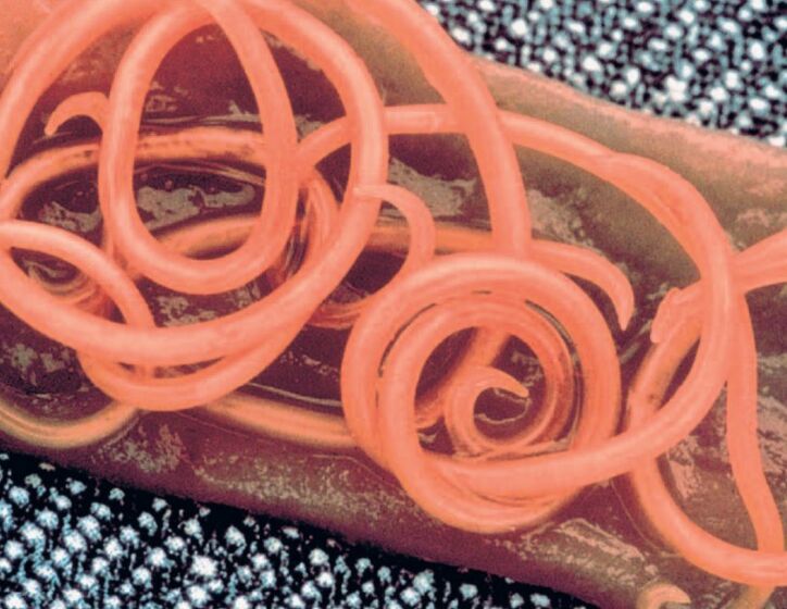 human body tapeworms