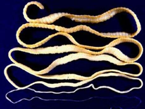 Tapeworm