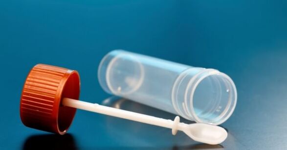 Parasitic tests